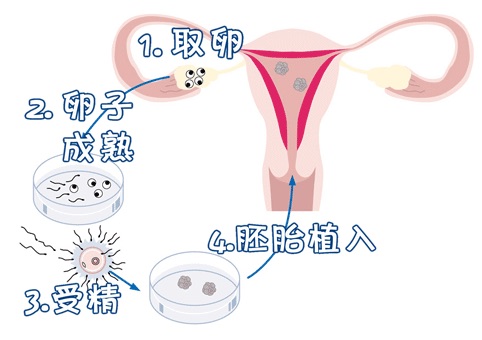 供卵供精公司